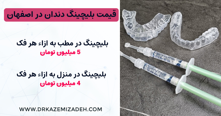 قیمت بلیچینگ در اصفهان 1403