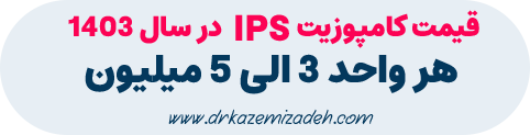 قیمت ونیر کامپوزیت در اصفهان در مطب دکتر سپیده کاظمی زاده