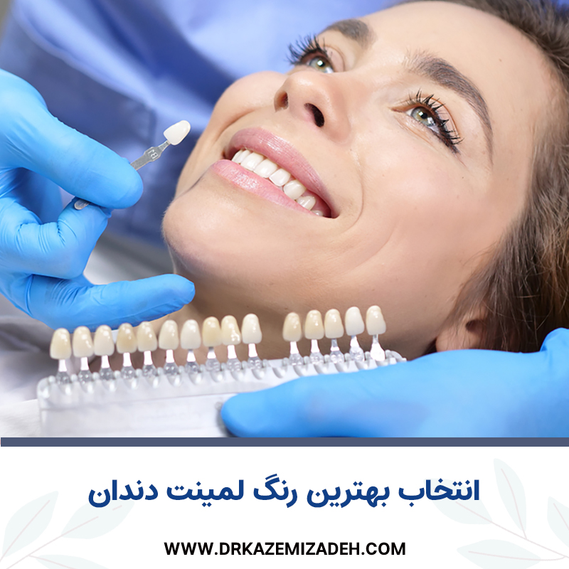 بهترین رنگ لمینت دندان | مطب دندانپزشکی دکتر سپیده کاظمی زاده در اصفهان