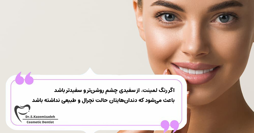 تناسب رنگ لمینت با رنگ چشم | مطب دندانپزشکی دکتر سپیده کاظمی زاده در اصفهان