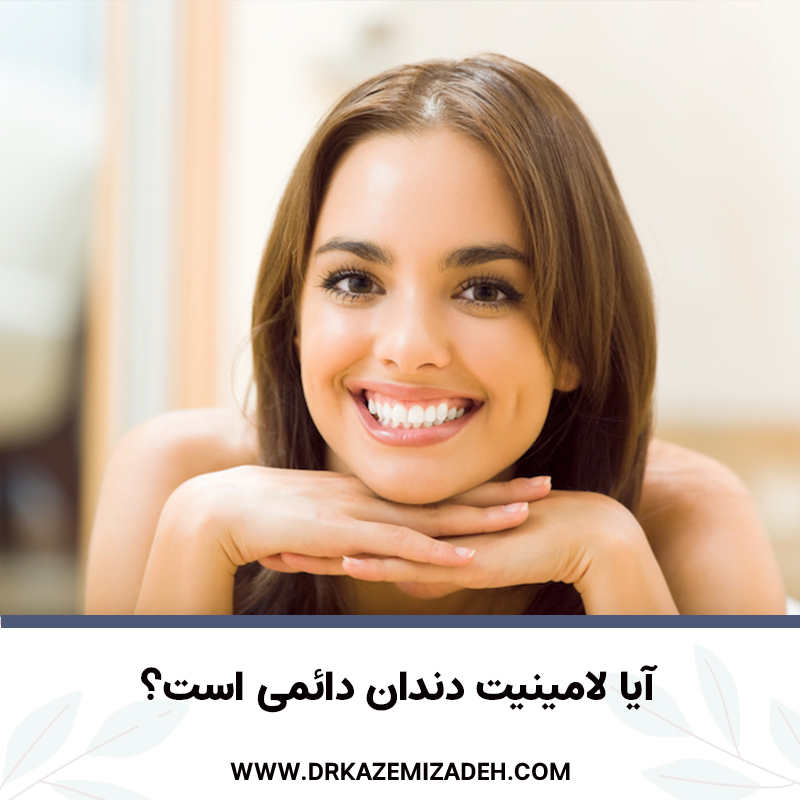 آیا لمینت دندان دائمی است؟ مطب دندانپزشکی دکتر سپیده کاظمی زاده در اصفهان