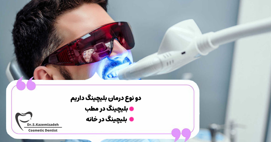 انواع روش های سفید کردن دندان | مرکز دندانپزشکی دکتر سپیده کاظمی زاده در اصفهان