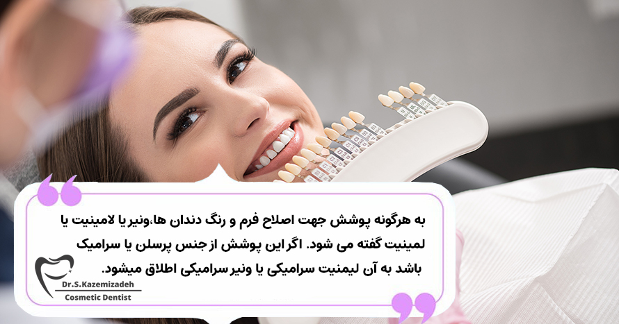 لمینت و اصلاح طرح لبخند | مرکز دندانپزشکی زیبایی دکتر کاظمی زاده در اصفهان