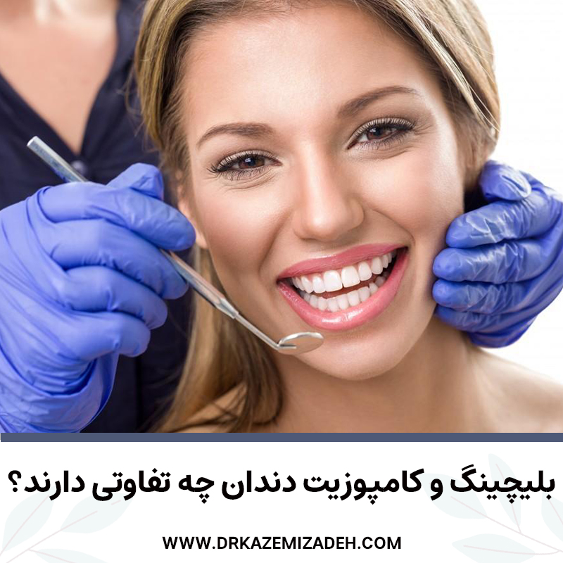 تفاوت بین کامپوزیت و بلیچینگ دندان | مطب دکتر سپیده کاظمی زاده متخصص دندانپزشکی زیبایی و ترمیمی