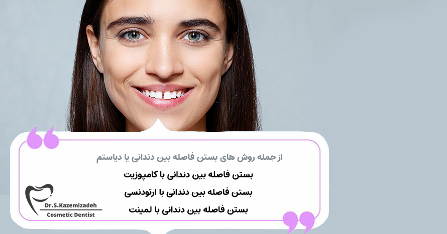 روش های بستن فاصله بین دندانی | مرکز دندانپزشکی زیبایی دکتر کاظمی زاده در اصفهان