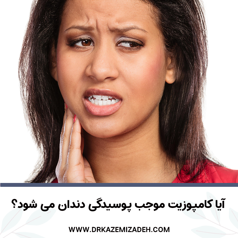 آیا کامپوزیت موجب پوسیدگی دندان می شود؟ | مطب دندانپزشکی دکتر سپیده کاظمی زاده در اصفهان