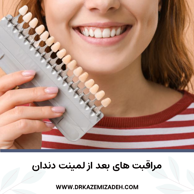 مراقبت های بعد از لمینت دندان | مطب دکتر سپیده کاظمی زاده در اصفهان