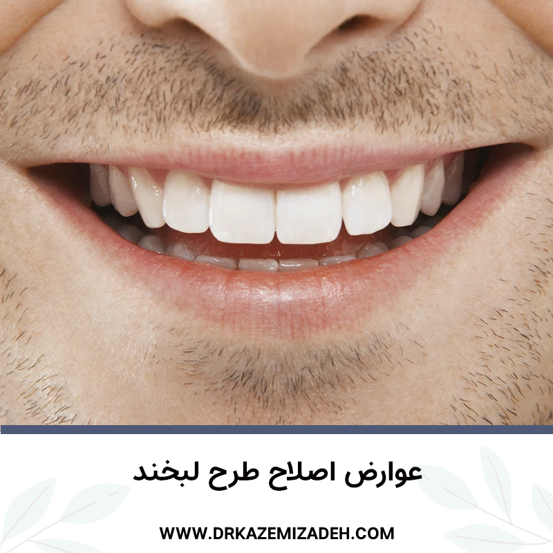 عوارض اصلاح طرح لبخند | مرکز دندان پزشکی دکتر سپیده کاظمی زاده در اصفهان