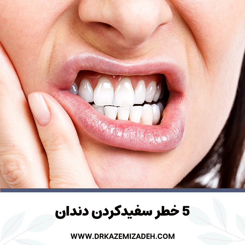 5 خطر سفیدکردن دندان | دکتر سپیده کاظمی زاده