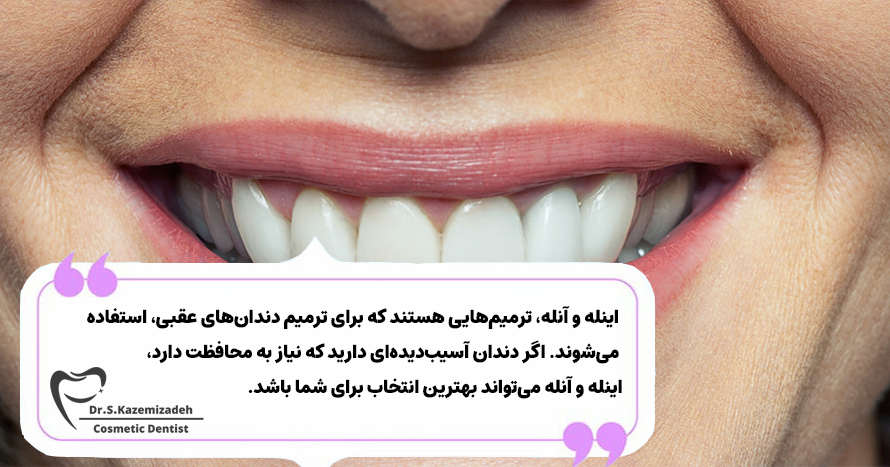  آیا اینله و آنله برای من مناسب هستند؟ | دکتر سپیده کاظمی زاده
