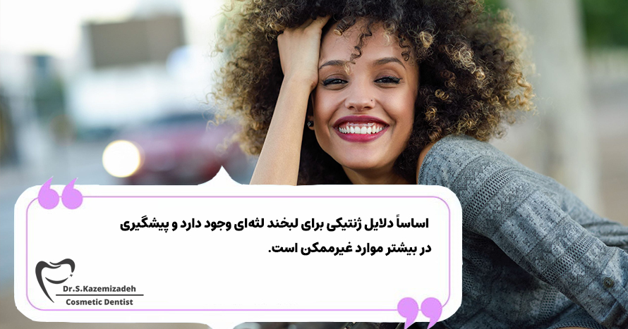 علت لبخند لثه ای | مرکز دندانپزشکی دکتر سپیده کاظمی زاده