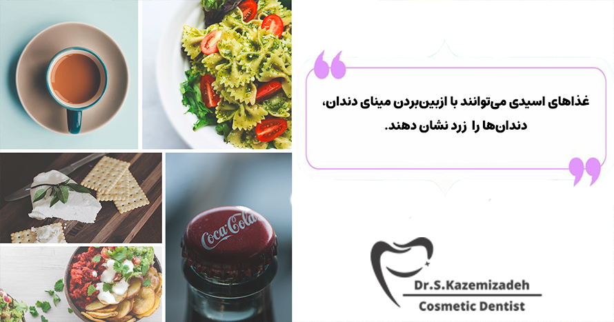 تاثیر غذا های اسیدی بر روی مینای دندان | دکتر سپیده کاظمی زاده