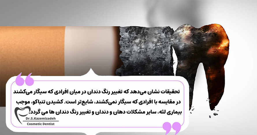 تغییر رنگ دندان با مصرف سیگار | دکتر سپیده کاظمی زاده