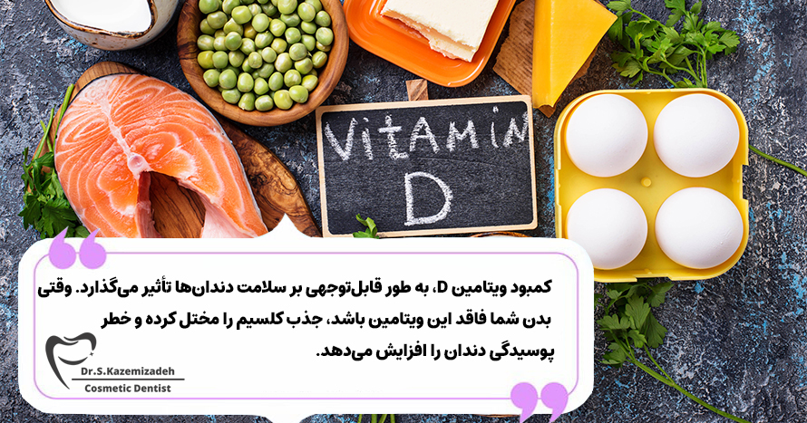 کمبود ویتامین D و تغییر رنگ دندان | دکتر سپیده کاظمی زاده