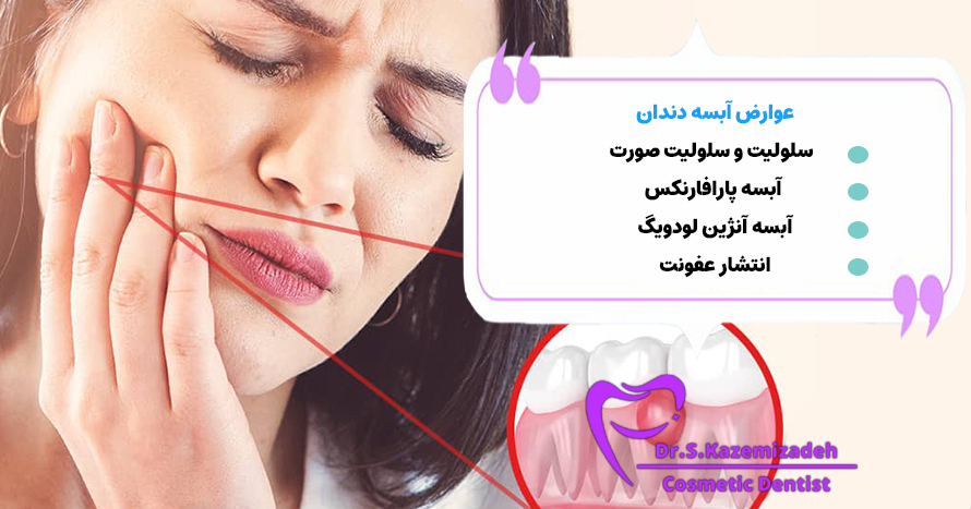 عوارض آبسه دندان | دکتر سپیده کاظمی زاده در اصفهان