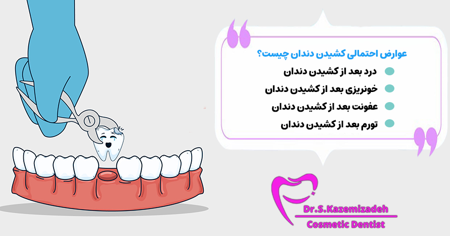 عوارض احتمالی کشیدن دندان چیست؟ | دکتر سپیده کاظمی زاده در اصفهان