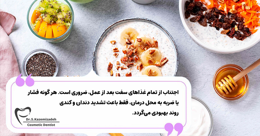 بایدها و نبایدهای رژیم غذایی بعد از کشیدن دندان | دکتر سپیده کاظمی زاده، متخصص دندانپزشکی زیبایی و ترمیمی