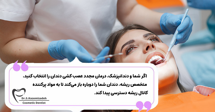 درمان مجدد کانال ریشه | عصب کشی مجدد دندان 