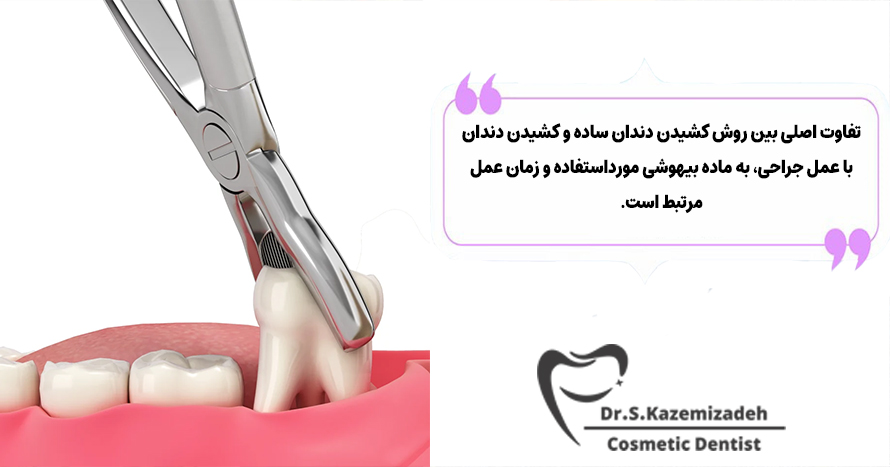 تفاوت بین کشیدن دندان با جراحی و کشیدن دندان ساده | مطب دکتر سپیده کاظمی زاده
