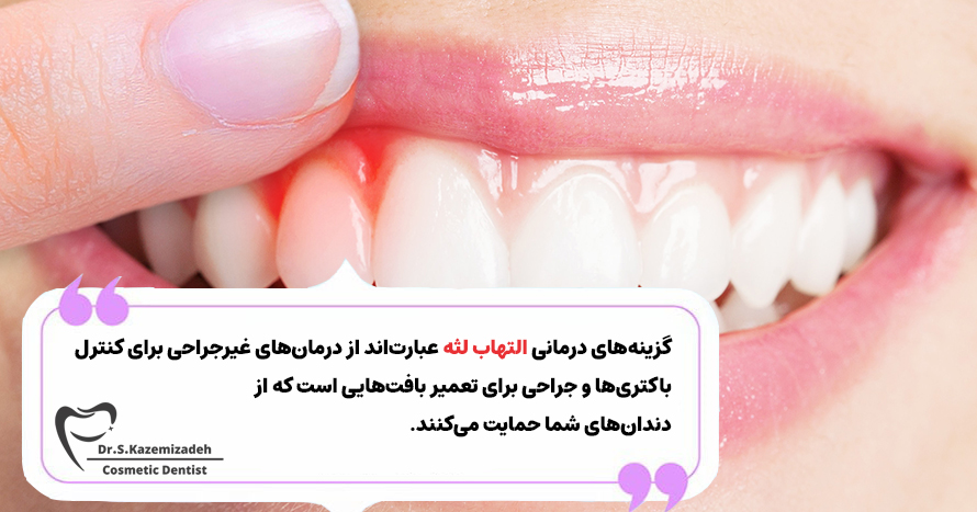 درمان بیماری لثه | مطب دکتر کاظمی زاده در اصفهان