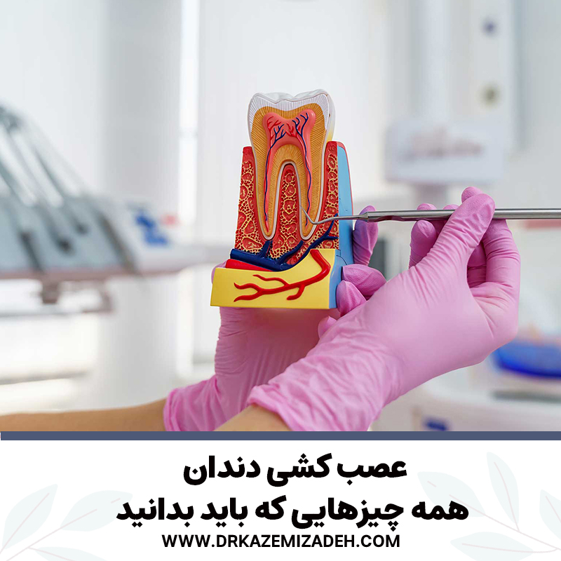 عصب کشی دندان: همه چیزهایی که باید بدانید | دکتر سپیده کاظمی زاده