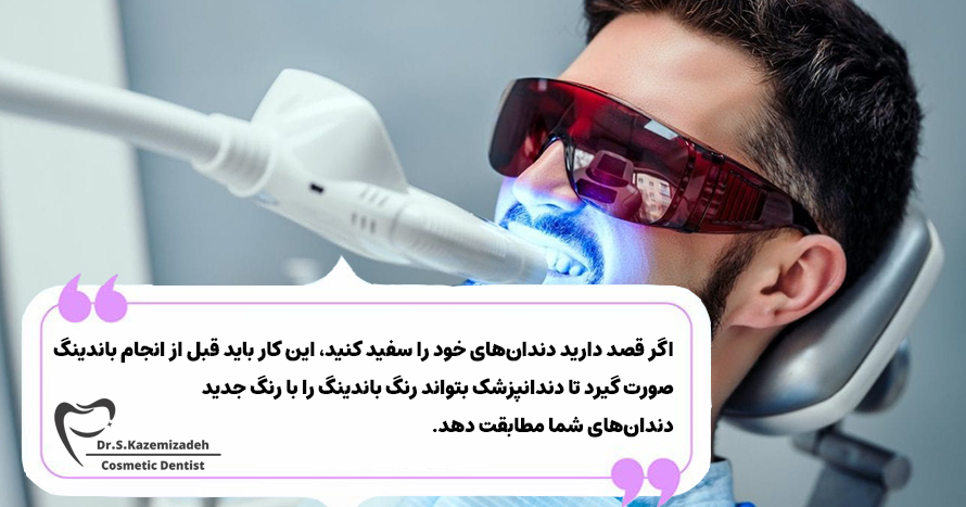 باندینگ و سفیدکردن دندان | دکتر سپیده کاظمی زاده در اصفهان