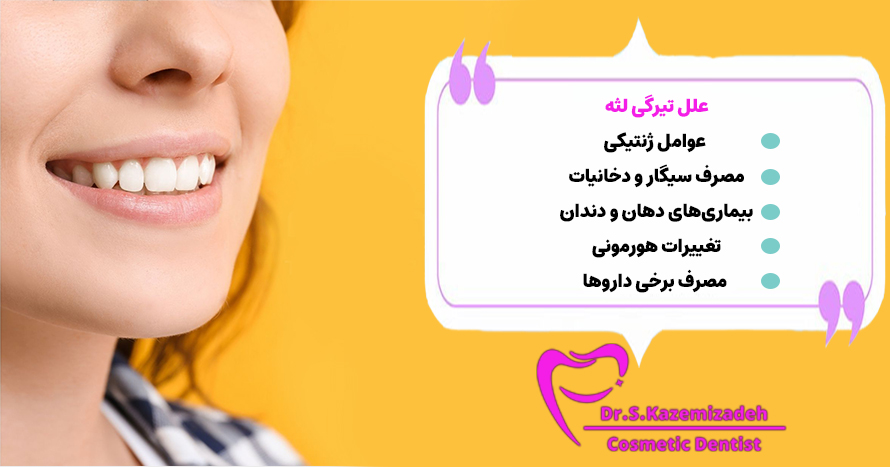 علل تیرگی لثه | مطب دندانپزشکی دکتر سپیده کاظمی زاده در اصفهان