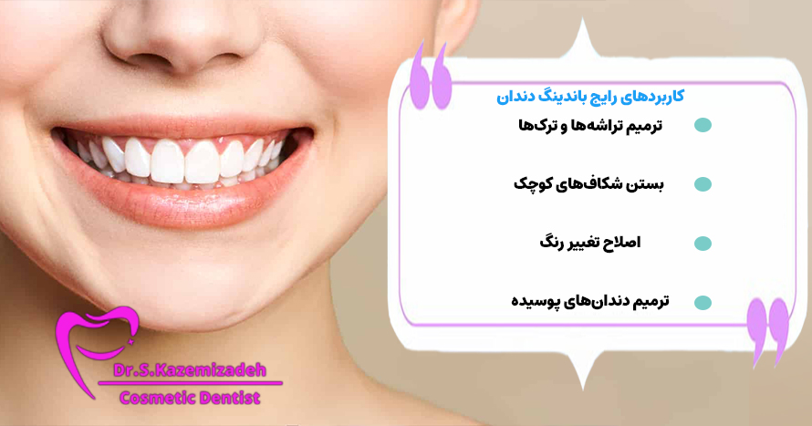 کاربردهای رایج باندینگ دندان | دکتر سپیده کاظمی زاده در اصفهان