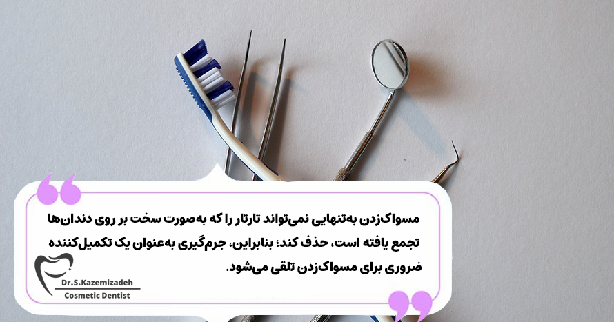 مقایسه جرم‌گیری دندان با سایر روش‌های پاک‌سازی دندان و دهان | دکتر سپیده کاظمی زاده در اصفهان