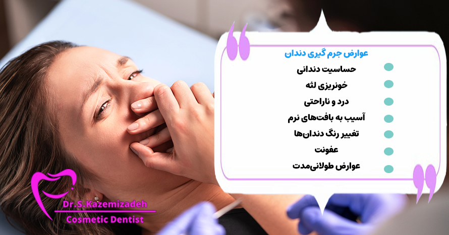 عوارض جرم‌گیری دندان | دکتر سپیده کاظمی زاده در اصفهان