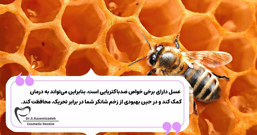 درمان‌های خانگی برای آفت دهان | دکتر سپیده کاظمی زاده در اصفهان