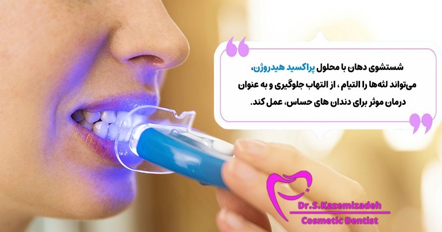 محلول پراکسید هیدروژن برای جلوگیری از حساسیت دندان | دکتر سپیده کاظمی زاده در اصفهان