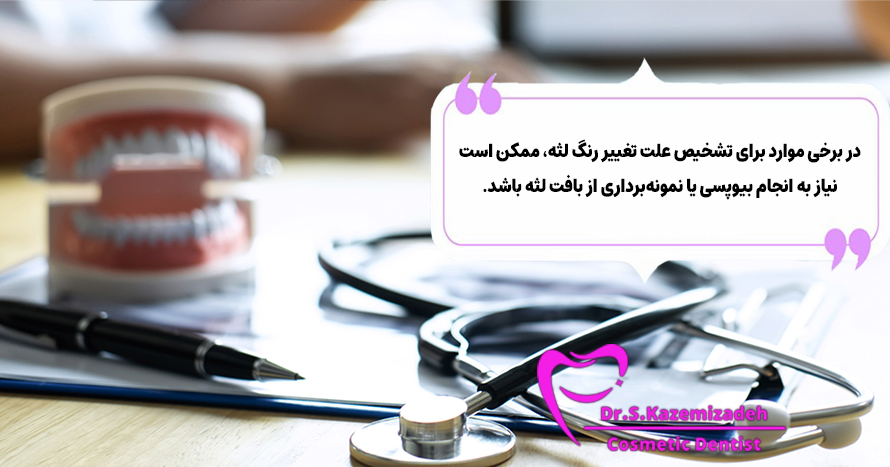 تشخیص علت تیرگی لثه | دکتر سپیده کاظمی زاده در اصفهان