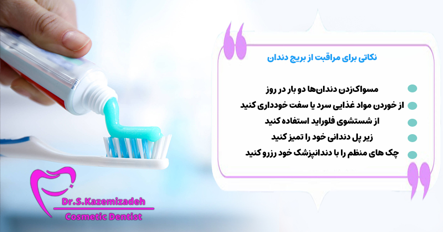 نکاتی برای مراقبت از بریج دندان | بهترین متخصص دندانپزشکی ترمیمی اصفهان، خانم دکتر سپیده کاظمی زاده