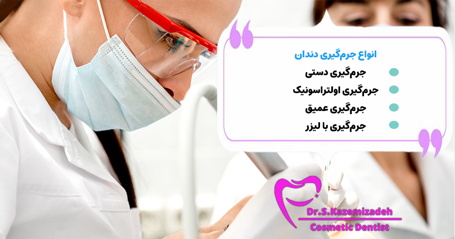 انواع جرم گیری دندان | دکتر سپیده کاظمی زاده