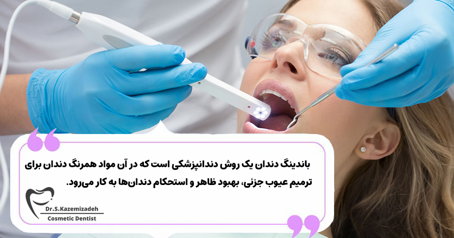 باندینگ دندان چیست؟ | دکتر سپیده کاظمی زاده در اصفهان