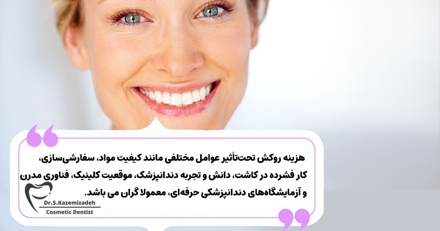 آیا روکش‌ها گران هستند؟ | دکتر سپیده کاظمی زاده در اصفهان