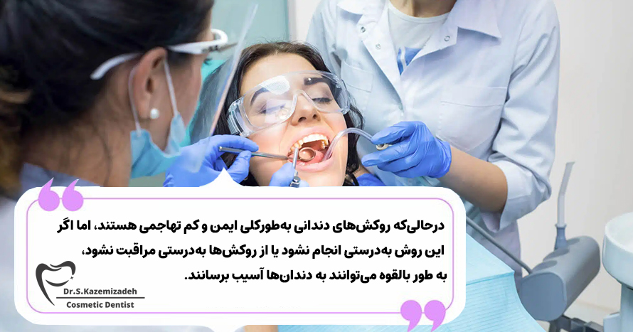 آیا روکش‌های دندانی می‌توانند به دندان‌های من آسیب بزنند؟ | مرکز دندانپزشکی زیبایی اصفهان