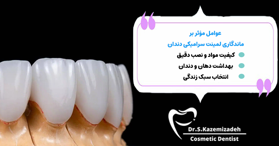 عوامل مؤثر بر ماندگاری لمینت سرامیکی دندان | متخصص مناسب لمینت دندان اصفهان