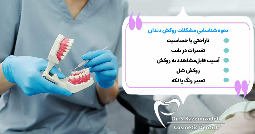 نحوه شناسایی مشکلات روکش دندان | دکتر سپیده کاظمی زاده در اصفهان