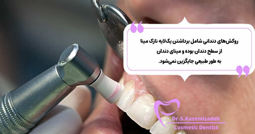 عوارض جانبی روکش‌های دندانی | دکتر سپیده کاظمی زاده
