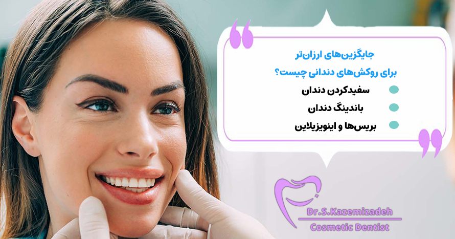 جایگزین‌های ارزان‌تر برای روکش‌های دندانی چیست؟ | دکتر سپیده کاظمی زاده در اصفهان