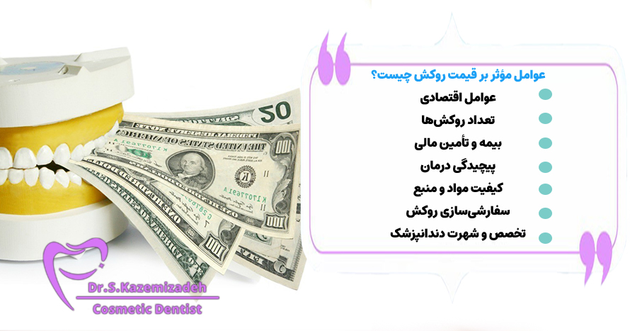 عوامل مؤثر بر قیمت روکش چیست؟ | بهترین قیمت روکش دندان اصفهان