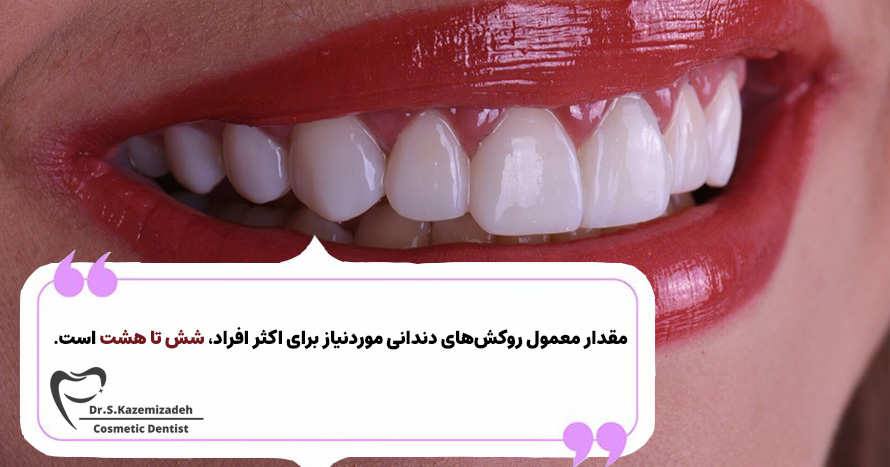 مقدار معمول ونیر دندان موردنیاز چقدر است؟ | دکتر سپیده کاظمی زاده در اصفهان