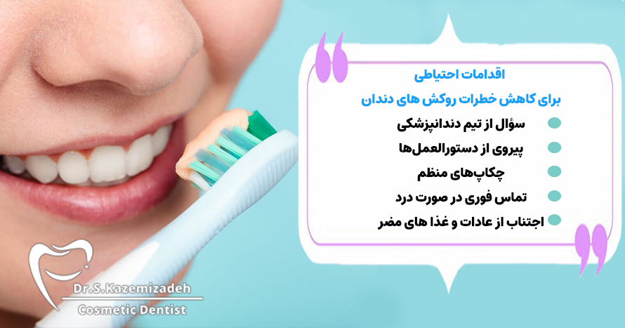 چه اقدامات احتیاطی می‌توانم برای کاهش خطرات مرتبط با ونیرهای دندان انجام دهم؟ | دکتر سپیده کاظمی زاده، متخصص دندانپزشکی زیبایی اصفهان 