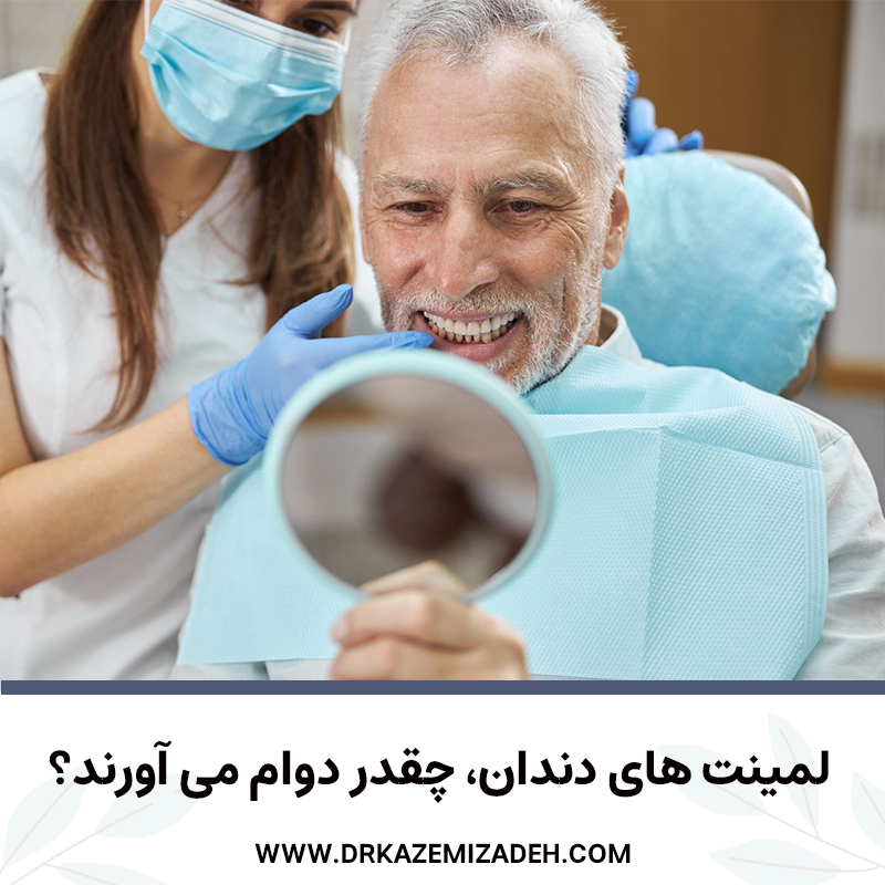 لمینت های دندان چقدر دوام دارند؟ | دکتر سپیده کاظمی زاده در اصفهان