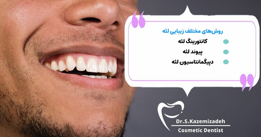 روش های مختلف زیبایی لثه | دکتر سپیده کاظمی زاده