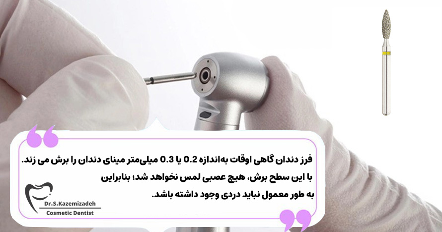 احساس درد لمینت و کامپوزیت دندان در مراحل مختلف نصب روکش | دکتر سپیده کاظمی زاده