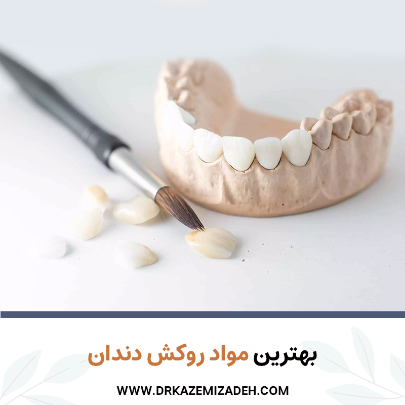 بهترین مواد روکش دندان برای شما چیست؟ | دکتر سپیده کاظمی زاده در اصفهان