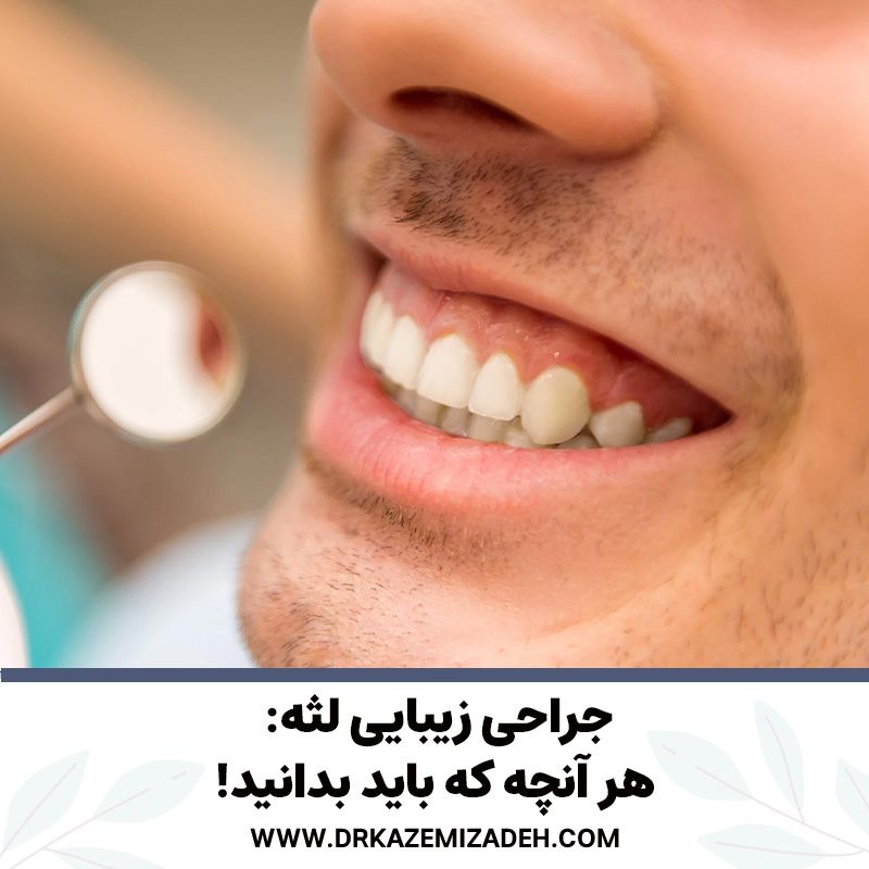 جراحی زیبایی لثه: هر آنچه که باید بدانید! | دکتر سپیده کاظمی زاده در اصفهان